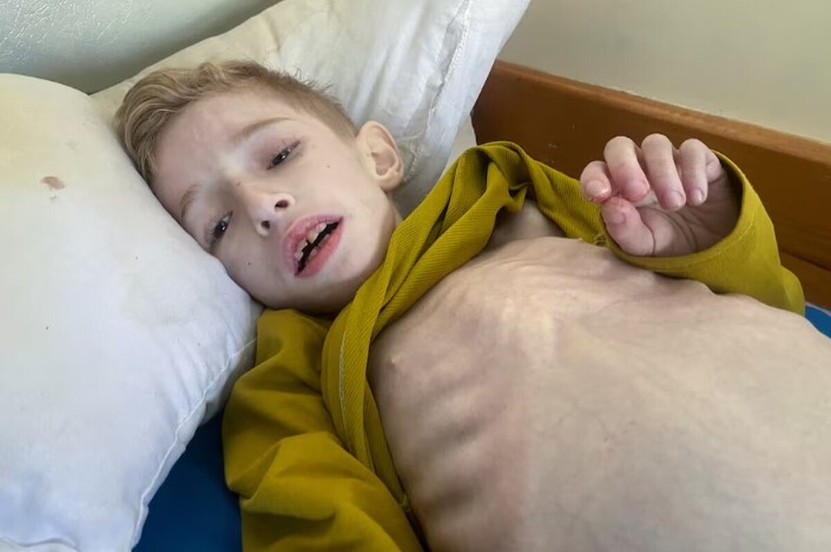 بخش‌های بیمارستانی غزه مملو از کودکان قحطی‌زده